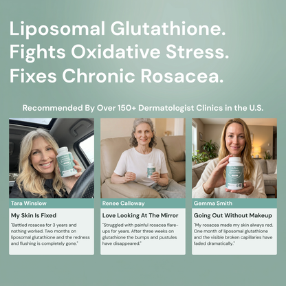 MicroRoot Liposomal Glutathione – Naturally Fix Your Skin's Rosacea